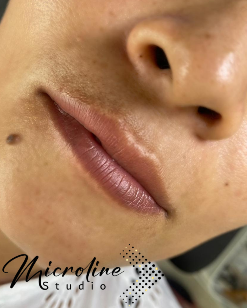 Antes: Micropigmentación de labios