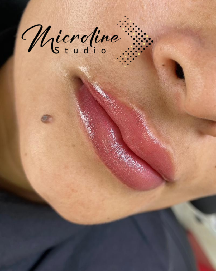 Después: Micropigmentación de labios