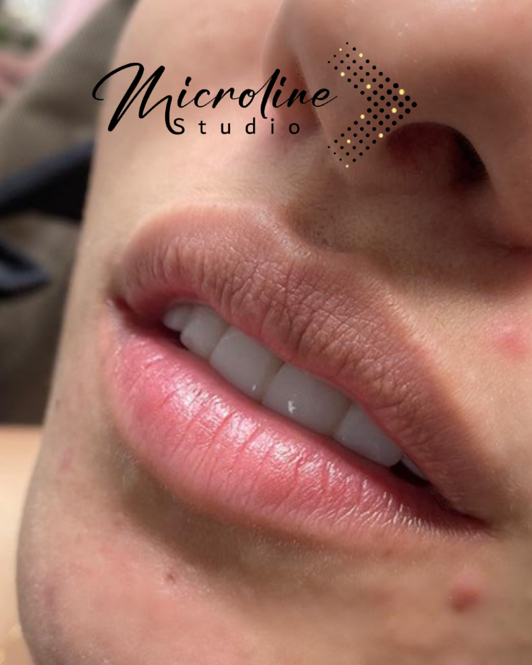 MICROPIGMENTACION YOPAL (5)